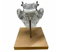 FHUILIJH Transparent Lumbar and Sacral Spine Model Fusion and Internal Fixation Training Model for Doctors Office Educational Tool,Clear,18cm