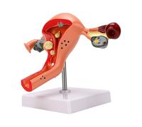 FILFEEL Pathological Uterus Model Female Reproductive System Model Cross Sectional Ovary Fallopian Tubes Uterus Vagina with Display Base