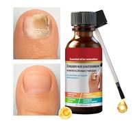 Fingernail Repair | 20ml Compact Fingernail Hardening Liquid | Multi-Purpose Nail Repair Liquid - for Women Boys Girls Youth Teens Grandma Grandpa Son Daughter Family Friends
