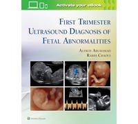 First Trimester Ultrasound Diagnosis of Fetal Abnormalities