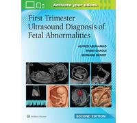 First Trimester Ultrasound Diagnosis of Fetal Abnormalities