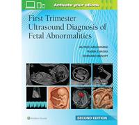 First Trimester Ultrasound Diagnosis of Fetal Abnormalities