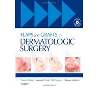Flaps and Grafts in Dermatologic Surgery: Text with DVD
