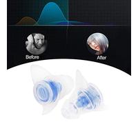 Focket Anti -NODLIGE -THIPS HIGH Fidelity Hörschutz for Music Festivals Reduces The Noise of Concerts for Concerts (Blue)