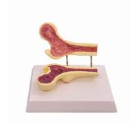 Fonowx Life Size Structural Model with Base | Two Part sectioned Design, Osteoporosis Model, Educational, for Doctor Office, Classroom, Educators