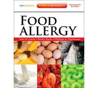 Food Allergy: Expert Consult Basic