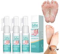 Foot Callus Removal Spray, Professional Callus Remover Extra Strength Spray, Instant Foot Peeling Spray, Foot Peel Spray for Cracked Rough Heels Calluses & Dry Toe Skin (3)