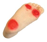 Foot Care Teaching Model - Diabetic & Geriatric Nursing Tool for Patient Education and Science Study, Invasive Lesion Ulcer Model for Healthcare Training
