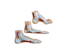 Foot Pathology Model Normal/Flat/High Arch Foot Anatomy with Muscles Bones Medical Teaching Display for Podiatry Education