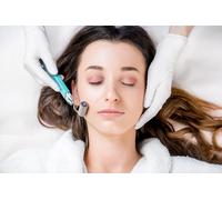 For 1 session: Micro-needling for face with Hyaluronic Acid