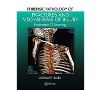 Forensic Pathology of Fractures and Mechanisms of Injury: Postmortem CT Scanning