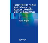 Fracture Finder: A Practical Guide to Interpreting Upper and Lower Limb X-Rays for Radiographers