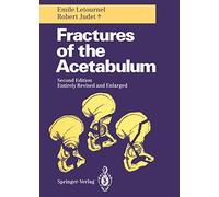 Fractures of the Acetabulum