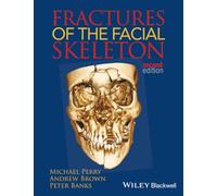 Fractures of the Facial Skeleton, 2nd Edition