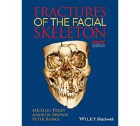 Fractures of the Facial Skeleton, 2nd Edition