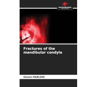 Fractures of the mandibular condyle