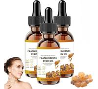 Frankincense Oil, Frankincense Resin Oil, Deep Hydration For Face And Body, Reduces Fine Lines And Wrinkles, Soothes Repairs Skin, Hydrates Rejuvenates Natural Anti-Aging Serum (3)