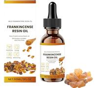 Frankincense Oil, Frankincense Resin Oil, Deep Hydration For Face And Body, Reduces Fine Lines And Wrinkles, Soothes Repairs Skin, Hydrates Rejuvenates Natural Anti-Aging Serum (1)