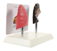 FRCOLOR Lung Anatomy Model and Smoking Lung Pathological Respiratory Model Medical Teaching Aid for Human Study