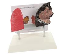 FRCOLOR Medical Smoking Lung Model for Teaching Human Respiratory Anatomy with Simulated Texture for Schools Nursing and Health Education