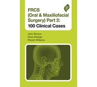 FRCS (Oral & Maxillofacial Surgery) Part 2: 100 Clinical Cases (Postgraduate)