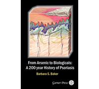 From Arsenic To Biologicals: A 200 Year History Of Psoriasis