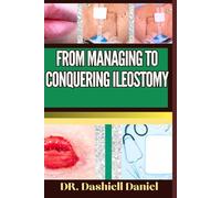 FROM MANAGING TO CONQUERING ILEOSTOMY: Expert Guide To Understanding the Causes, Recognizing Symptoms, Prevention and Embracing Effective Treatments for a Vibrant and Healthy Life