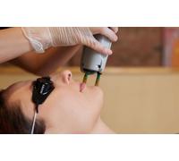 Full works 12 sessions of laser hair removal full body including Hollywood