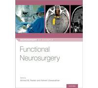 Functional Neurosurgery (Neurosurgery by Example)