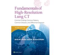 Fundamentals of High-Resolution Lung CT : Common Findings, Common Patterns, Common Diseases and Differential Diagnosis