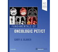 Fundamentals of Oncologic PET/CT (Fundamentals of Radiology)