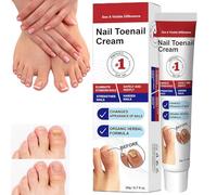 Fungal Nail Treatment Cream for Toenail,Antifu/ngal Cream,Fungus Nail Cream,Strong Anti-Fungal Toenail Cream,Nail Repair Cream,Suitable for Thick Cracked Discolored Nails,Safe Formula,Nail Care,20g