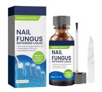 Fungal Nail Treatment, Extra Strong Nail Fungus Treatment For Toenail & Finger, Toe Fungus Treatment Nail Repair Growth Nail Softener for Thick Finger Nail 30ML