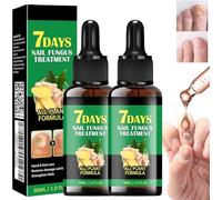 Fungal Nail Treatment, Ginger Nail Fungus Treatment, Correction Ingrown Toenail Drops, Trimming Toenail Softening Drops, Natural Ingrown Toenail Correction Fungal Nail (2PCS)