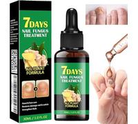 Fungal Nail Treatment, Ginger Nail Fungus Treatment, Correction Ingrown Toenail Drops, Trimming Toenail Softening Drops, Natural Ingrown Toenail Correction Fungal Nail (1PC)