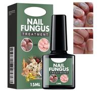 Fungal Nail Treatment,Nail Fungas Treatment Extra Strong,Toenail Fungus Treatment,Toenail Fungus Repair,Nail Growth Serum for Toenail and Fingernail,Anti Fungas N/ail Repair,N/ail Growth Oil,15ml