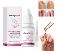 Fungigone Nail Treatment - Fungigone Official, Fungigone Nail Fungus Removal, 7 Days Nail Fungus Treatment, Nail Fungus Treatment for Toenail Strengthens and Smooths Cracked Nail Surface (1Pcs)