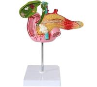 Gallstone Surgery Gastroenterology System Hepatobiliary Model, Pathological Model of Gallbladder Biology, for Medical Students Education Study Assisted Dissection
