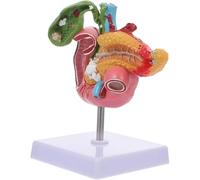 Gallstone Surgery Gastroenterology System Hepatobiliary Model Pathological Model of Gallbladder Biology Teaching Model Pancreatic Medical Pancreas Duodenum Gallbladder Pathological Model