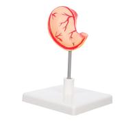 GALPADA Realistic Teaching Aid for High Precision Structure for Classroom and Clinical Use Stomach Organ Model for Enhanced Learning Efficiency