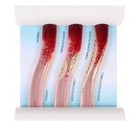 Garneck Human Body Vascular Model Blood Vessel Anatomical Model for for Instructors Doctors and Students Demonstrates Impact Blood