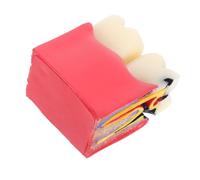 Garneck Magnified Caries Tooth Model for Anatomy Study Educational Decay Demonstration Tool for Teachers Students and Clinics Oral Health Teaching Aid for Classroom and Patient Use