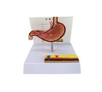 Gastric Perforation Anatomy Model Pathological Stomach Model Teaching Tool for Clinical Demonstration Gastric Simulation