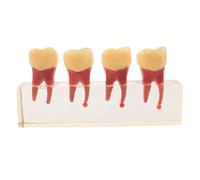 Gatuida Cross-section Model with Pulp Structure for Primary, Resin Oral Anatomy Teaching Aid Supporting Dentist-patient Communication and Classroom Model Use
