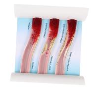 Gatuida Medical Teaching Blood Vessel Model Dynamic Vascular Anatomy Model for Medical Education for Clinical Study