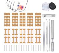 GEMSANVA Ingrown Toenail Corrector Set with Correction Strips,Professional Ingrown Toenail Tool kit,Curved Toenails Corrector Patch,For Home Pedicure Care