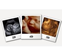 Gender ultrasound scan with 2 picture