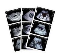 Generic Personalizable Fake Ultrasound Image - Funny Gift & Novelty Item for Pregnancy Announcement, Baby Shower Decoration, Surprise for Family & Friends