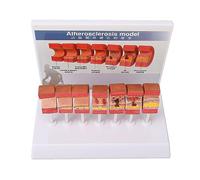 Generic Procedural Artery Model, Replica Model 7PCS Artery Anatomical Vessel Atherosclerosis Thrombus Vascular for Doctors Office Educational Tool