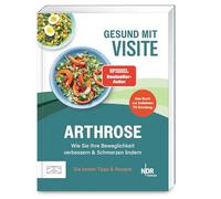 Gesund mit Visite - Arthrose: Wie Sie Ihre Beweglichkeit verbessern & Schmerzen lindern